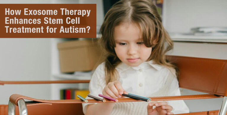 Exosome Therapy Enhances Stem Cell Treatment
