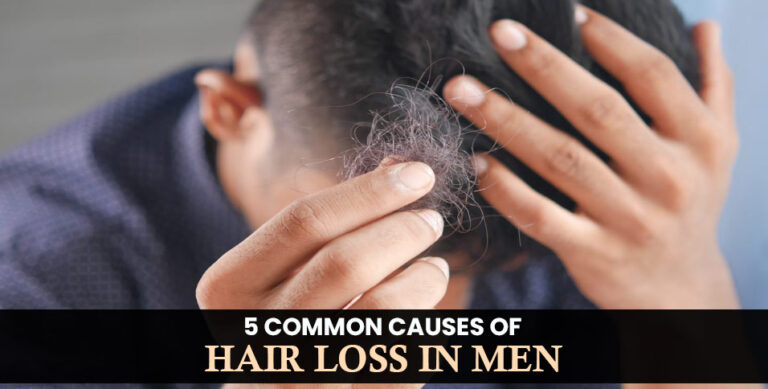 Causes of Hair Loss