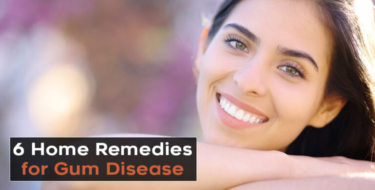 Home Remedies for Gum Disease