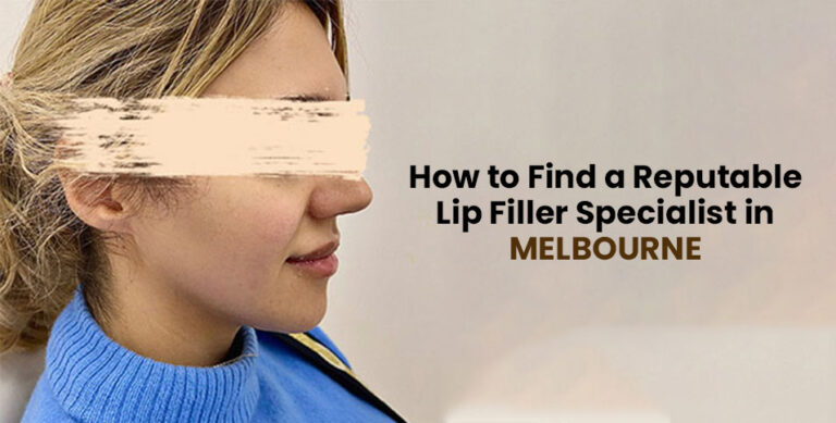 lip filler