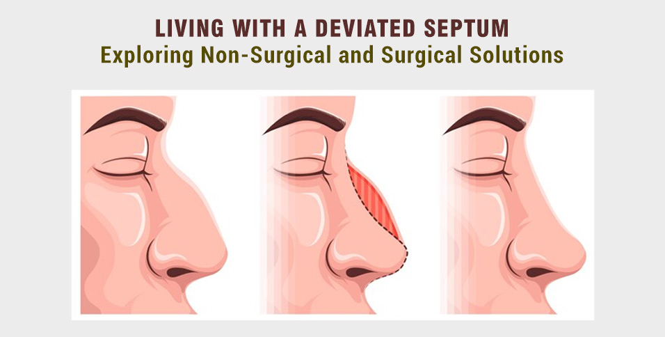 Deviated Septum