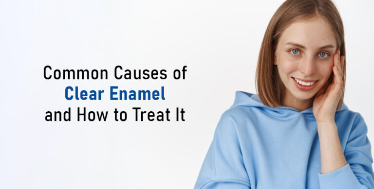 Common Causes of Clear Enamel