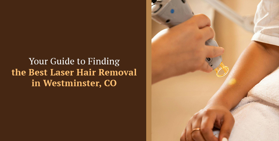 Laser Hair Removal in Westminster