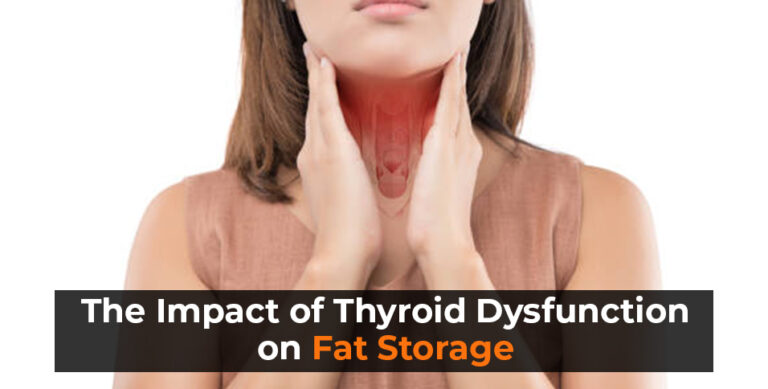 The-Impact-of-Thyroid-Dysfunction-on-Fat-Storage