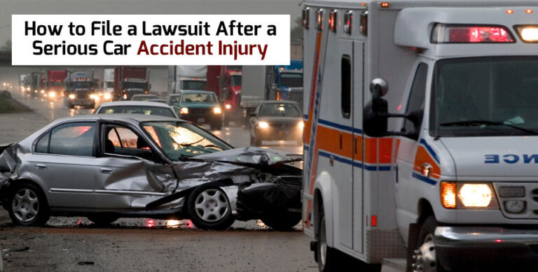 Lawsuit After a Serious Car Accident