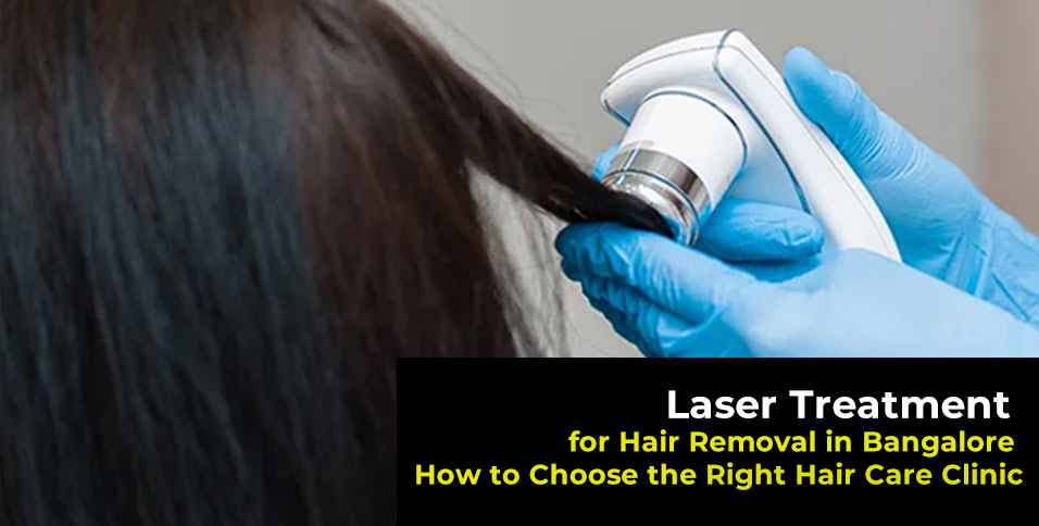 Laser Treatment for Hair Removal