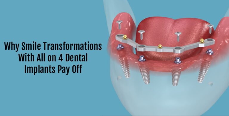 Dental Implants Pay Off