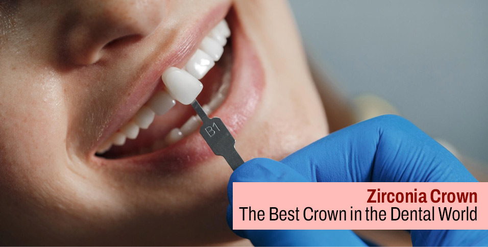 Zirconia Crown: The Best Crown in the Dental World
