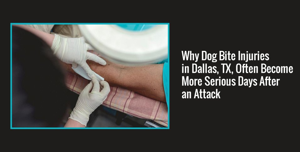 Dog Bite Injuries in Dallas