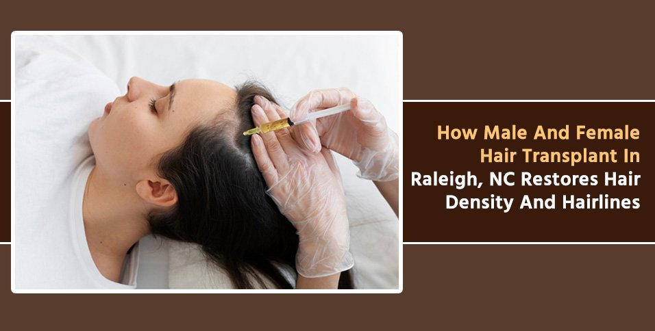 Hair Transplant Raleigh NC